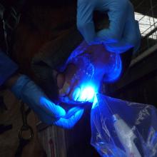 Curing the composite filling material on a patient's central incisor