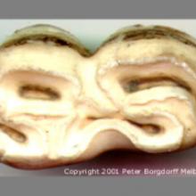 Lower Molar Occlusal Surface